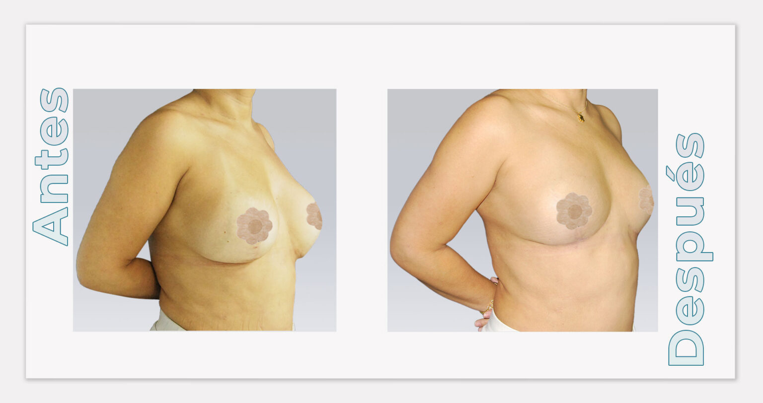 ESTRUCTURA-WEB-RESULTADOS-3