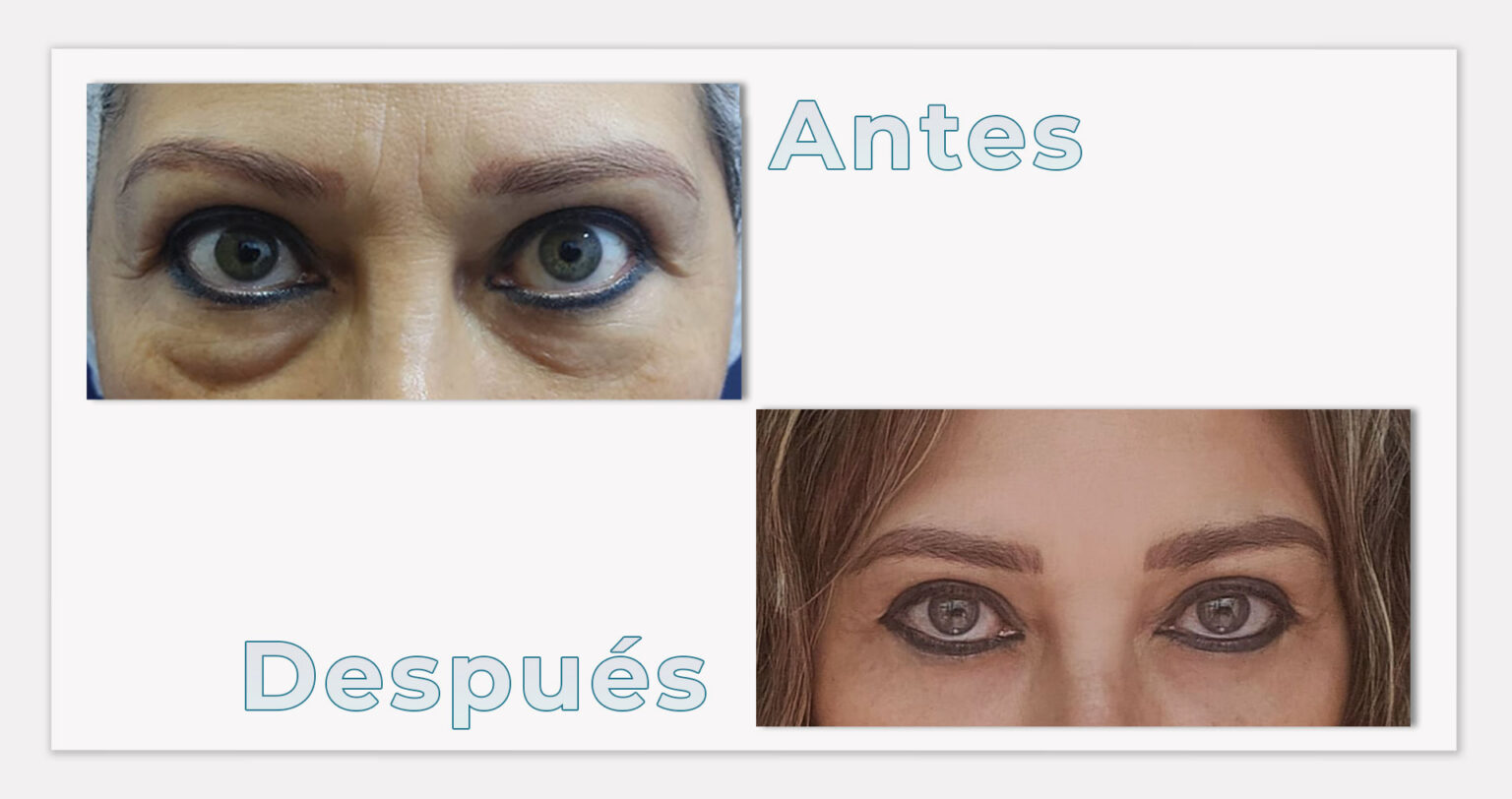 ESTRUCTURA-WEB-RESULTADOS-4