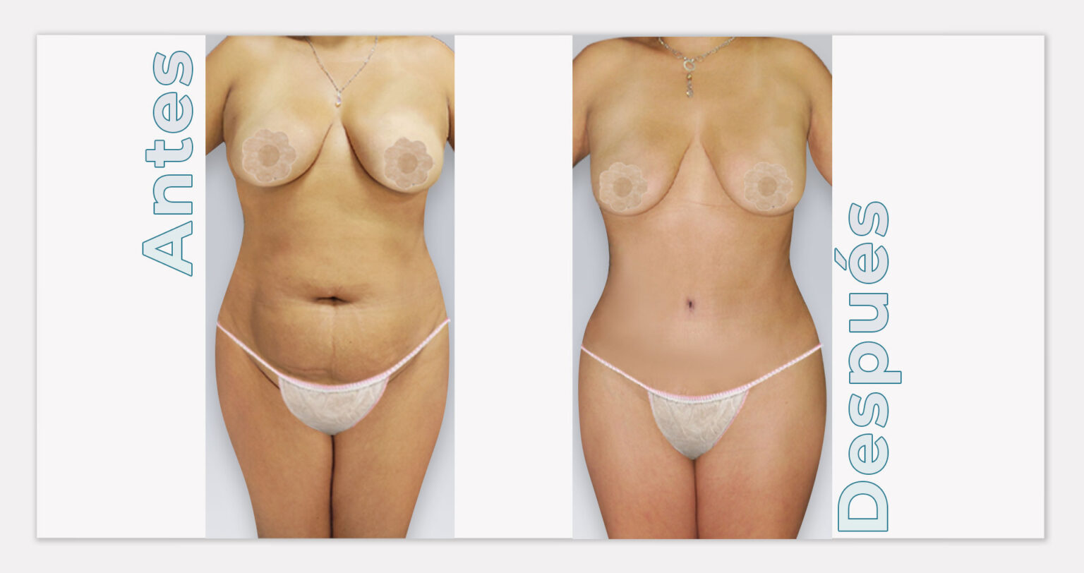 ESTRUCTURA-WEB-RESULTADOS-5